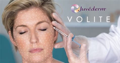 juvederm volite hydration.